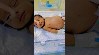 Intestinal Obstruction Intestinal Sepsis Abdominal Infection ytshortsindia viralvideos tranding [upl. by Oiznun]