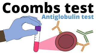 Coombs Test antiglobulin test [upl. by Otrebilif]