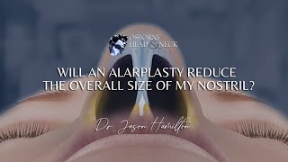 Will alarplasty surgery reduce the overall size of my nostrils and narrow my nose [upl. by Aicilec]