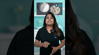 chewing gum நான் சாப்பிடலாமா  which is best  Dental Advice in Tamil [upl. by Nyvek514]