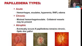 Clinical Grand Rounds in Optic Neuropathies Youve Got Some Nerve [upl. by Eerok]