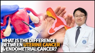 What is the difference between Uterine Cancer and Endometrial Cancer What is its survival rate [upl. by Pike681]