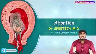 Abortion  Part 1   Obstetrics and Gynaecology Lecture [upl. by Prendergast]