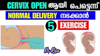 Cervix Open ആവാനും NORMAL DELIVERY ആവാനുള്ള Tips 9 Month Normal Delivery Exercise [upl. by Yborian]