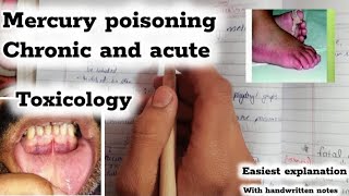 Mercury poisoning metallic poisons Toxicology [upl. by Sarah802]