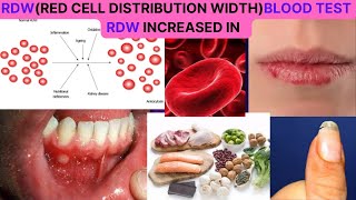 RDWRED CELL DISTRIBUTION WIDTH BLOOD TEST NORMAL RANGE CAUSES OF HIGH RDW HOW TO REDUCE IT [upl. by Mccurdy404]