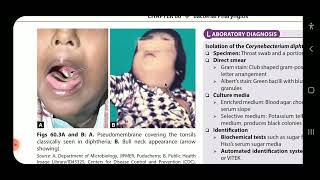 Apurba S Sastry Microbiology Bacterial Pharyngitis [upl. by Gershon61]