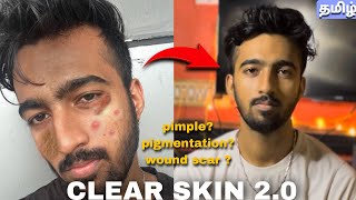 Get clear skin with science backup  தமிழ்  100 natural [upl. by Yerffoeg]