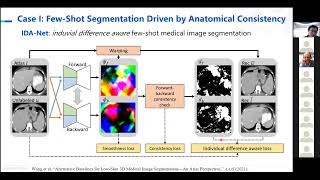 MICCAI Industrial Talk Data and AnnotationEfficient Deep Learning for Medical Image Analysis [upl. by Enal762]