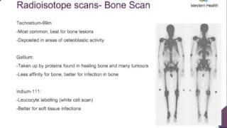 Orthopaedic Radiological Investigations by Dr Amy Gibbens [upl. by Sedecrem]