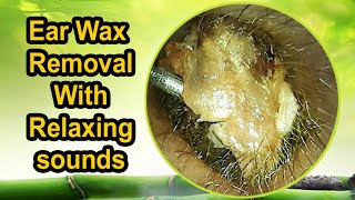 Dizzyness Inducing Earwax Removal with relaxing sounds [upl. by Ridglea]