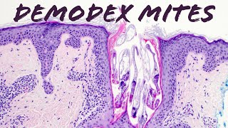 Demodex Mites under the microscope Demodex folliculorum amp Demodex brevis demodex mites on face [upl. by Goulet]