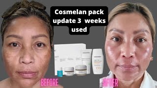 Update Cosmelan pack I been used for three weeks OMG my melasma getting better [upl. by Edmondo]