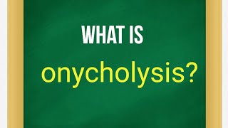 What is onycholysis [upl. by Darin]