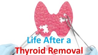 Life After a Thyroid Removal [upl. by Miksen67]