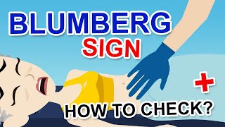 BLUMBERG SIGN [upl. by Attolrahc]