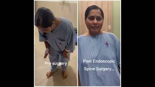 Endoscopic Spine treatment  Transforming lives happypatient painfreelife ‪Sanchetispinepune‬ [upl. by Puett]