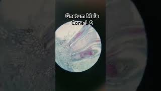 Slide view of gnetum male coneshortvideoscienceshortbotanymicroscopyworldshortvideoshortfeed [upl. by Rrats]