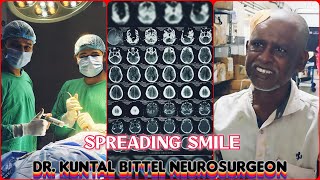 Spreading Smile  Chronic Subdural Hematoma  SDH  Complete Recovery  NEET UG  NEET PG  NEET SS [upl. by Far297]