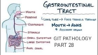 Intestine lactase deficiency abetalipoproteinemia amp microscopic colitis git pathology intestine [upl. by Tcideneb]