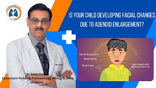 Facial changes due to Adenoid enlargement in children I Dr Ankit Parakh Child Pulmonologist [upl. by Let]