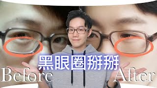 黑眼圈掰掰。我的眼週保養方法大公開【Dr 6】 [upl. by Letnuahc]