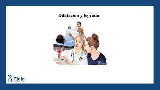 Dilatación y legrado [upl. by Liggett]