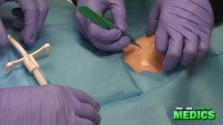 Surgical Cricothyrotomy by the Paramedic Intern [upl. by Luella]