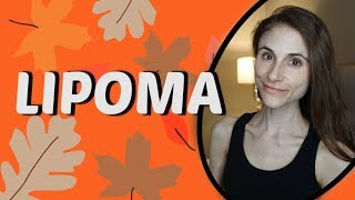 LIPOMA CAUSES TREATMENTS REMEDIES QampA WITH DERMATOLOGIST DR DRAY [upl. by Ajar766]