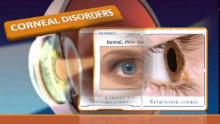 Care of Patients with Eye amp Vision Disorders [upl. by Edniya]