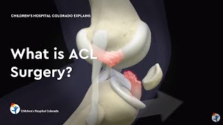 What is ACL Surgery [upl. by Zacharia]