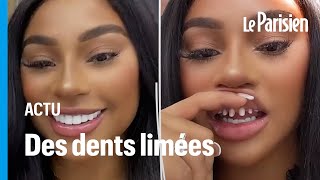 «Il aura un dentier à 30 ans»  la tendance des dents limées inquiète les dentistes [upl. by Nylasor595]