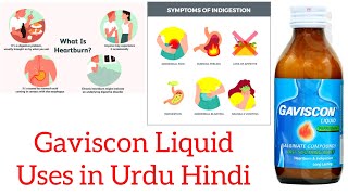 gavisçon syrup uses in urdu Hindi [upl. by Ansilma633]