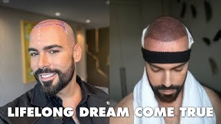 My Emotional Hair Transplant Journey in Istanbul Turkey with Hairneva [upl. by Arotal]