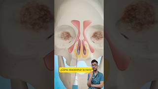 ¿Cómo desobstruir la nariz Sinuplastia con balón 🎈👃 curiosidades salud sabiasque medicina [upl. by Sanjiv149]