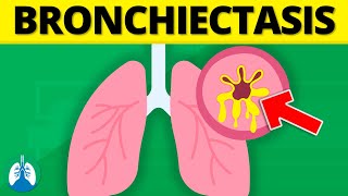 Bronchiectasis Medical Definition  Quick Explainer Video [upl. by Nylatsirk]