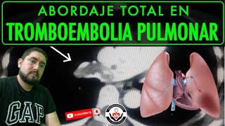 TROMBOEMBOLIA PULMONAR ABORDAJE TOTAL BY DR ZAMARRÓN [upl. by Fasa329]