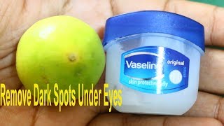 VASELINE That Will Change Your Life Forever  Skincare Beauty Hacks Remove Dark Skin Under eyes [upl. by Allie]