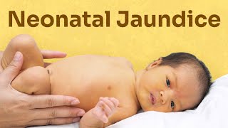 case presentation kse bnye neonatal jaundice prl how to make case presentation on neonatal jaundice [upl. by Iru21]