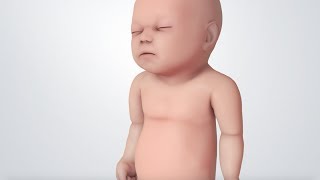 Infant Distress Warning Signs Grunting Baby Sound [upl. by Annohs]