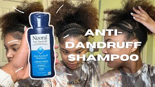 Dry Scalp and Dandruff Treatment Natural Hair  Nizoral AntiDandruff Shampoo [upl. by Nnep]