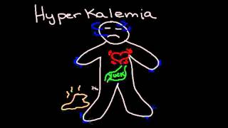 Hyperkalemia [upl. by Yenatirb]