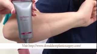 How To Apply Scar Gel or Cream [upl. by Trebma]