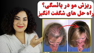 درمان ریزش مو در دوران یائسگی Menopausal Hair Loss [upl. by Pepillo]