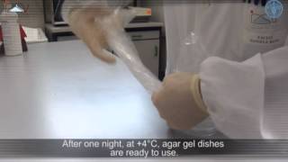 Agar gel immunodiffusion assay AGID [upl. by Plank]