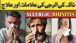 ALLERGIC Rhinitis And Its Treatment  Naak Ki Allergy Ka Ilaj  DrKashif Bilal [upl. by Gibbeon]