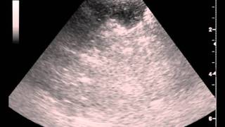 Dogs Ultrasound guided liver aspirate fenestration technique by Iowa Veterinary [upl. by Guenevere]