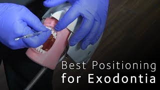 Best Positioning for Minimally Invasive Exodontia [upl. by Ardnekan]