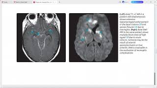 ultrasound radiologysonology [upl. by Phyl]