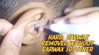 School Boys Hard Earwax Removed Without Earwax Softener [upl. by Alamak]